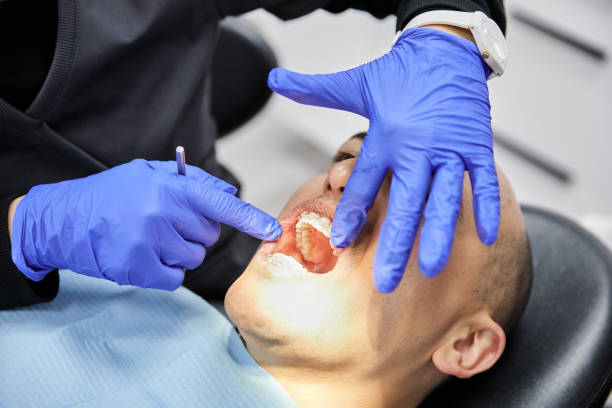 Best Emergency Dentist for Knocked-Out Tooth in Arp, TX
